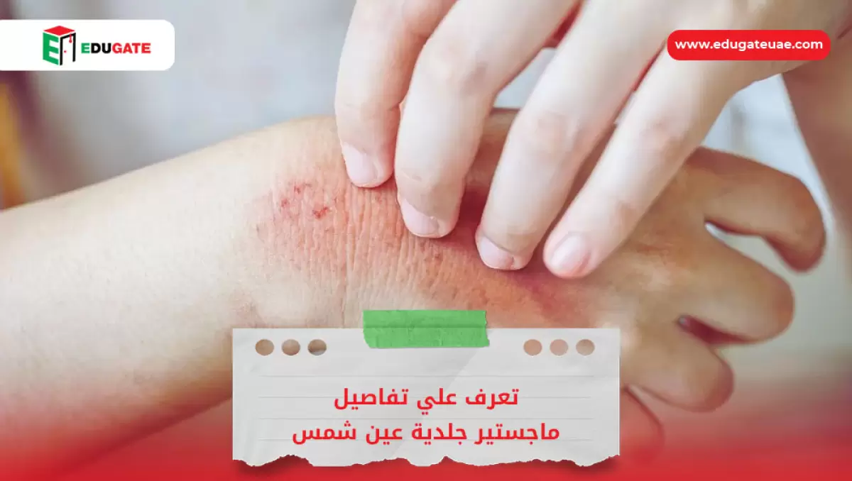 Blog Featured Image